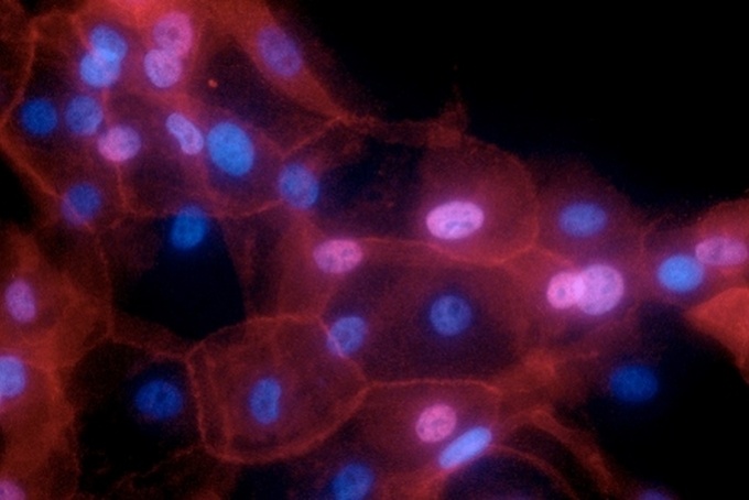 Új, otthon elvégezhető daganatdiagnosztikai eljárás fejleszthető lendületes kutatók felfedezéséből